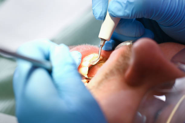 Best Cracked Tooth Emergency Dentist  in Grain Valley, MO