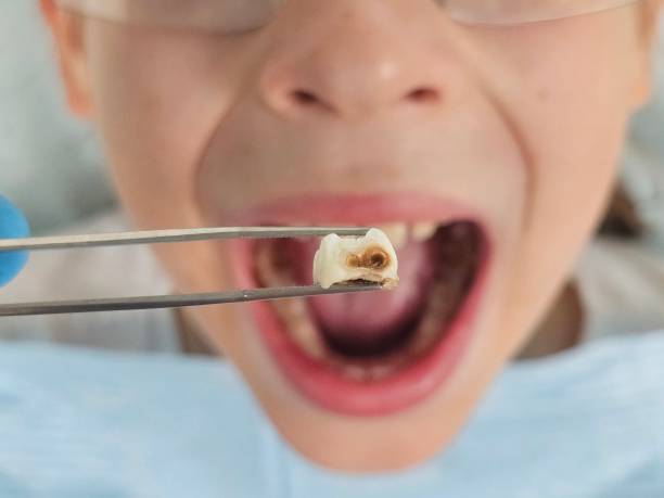 Best Emergency Pediatric Dentist  in Grain Valley, MO